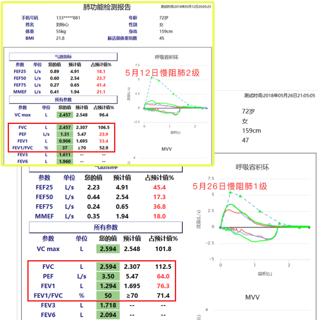 &#24320;&#20113;&#40;&#20013;&#22269;&#41;&#75;&#97;&#105;&#121;&#117;&#110;
