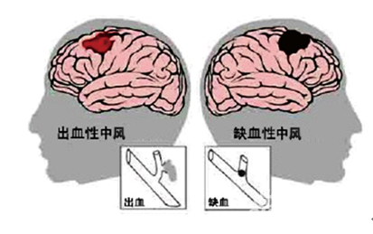 &#24320;&#20113;&#40;&#20013;&#22269;&#41;&#75;&#97;&#105;&#121;&#117;&#110;