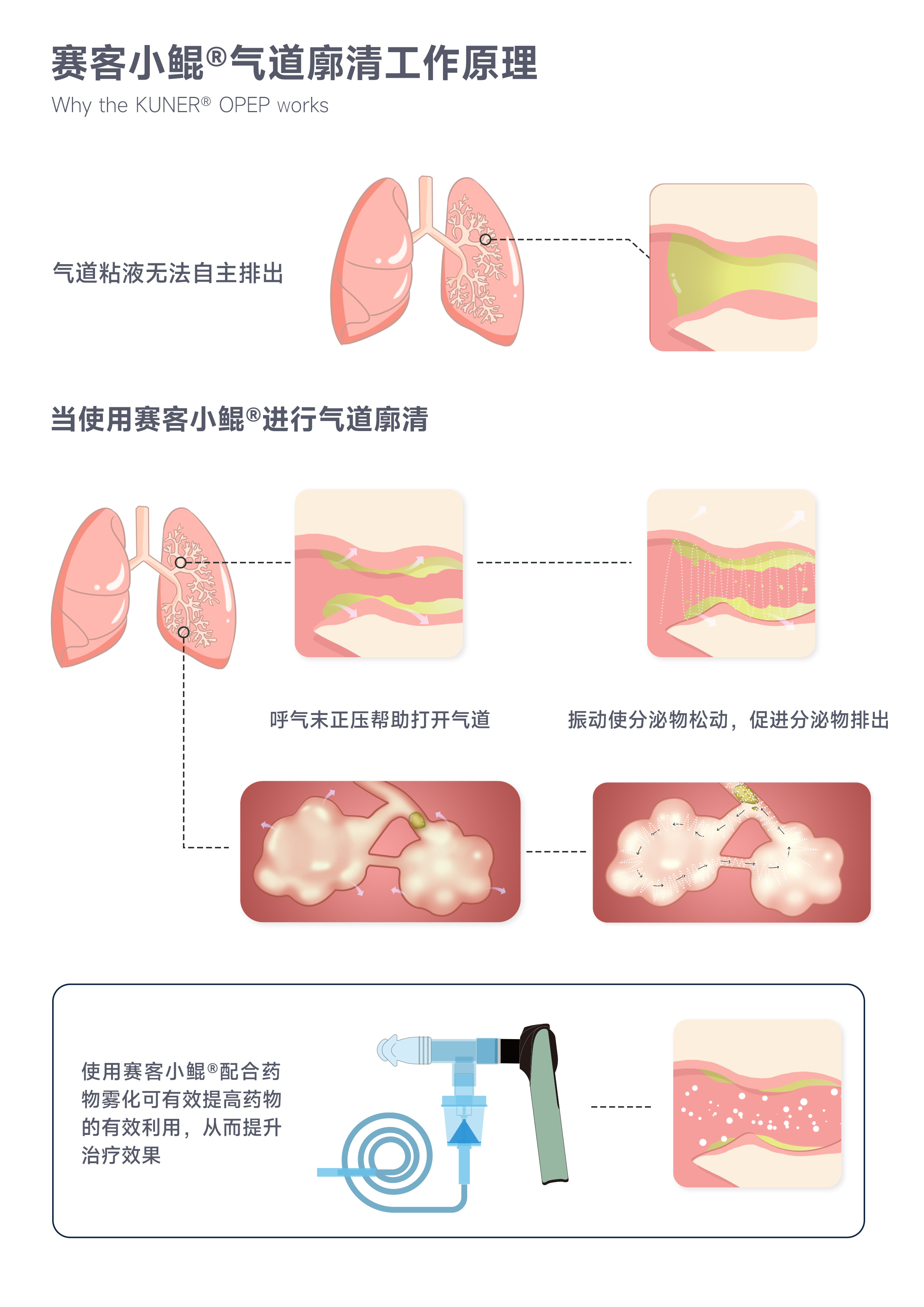 &#24320;&#20113;&#40;&#20013;&#22269;&#41;&#75;&#97;&#105;&#121;&#117;&#110;